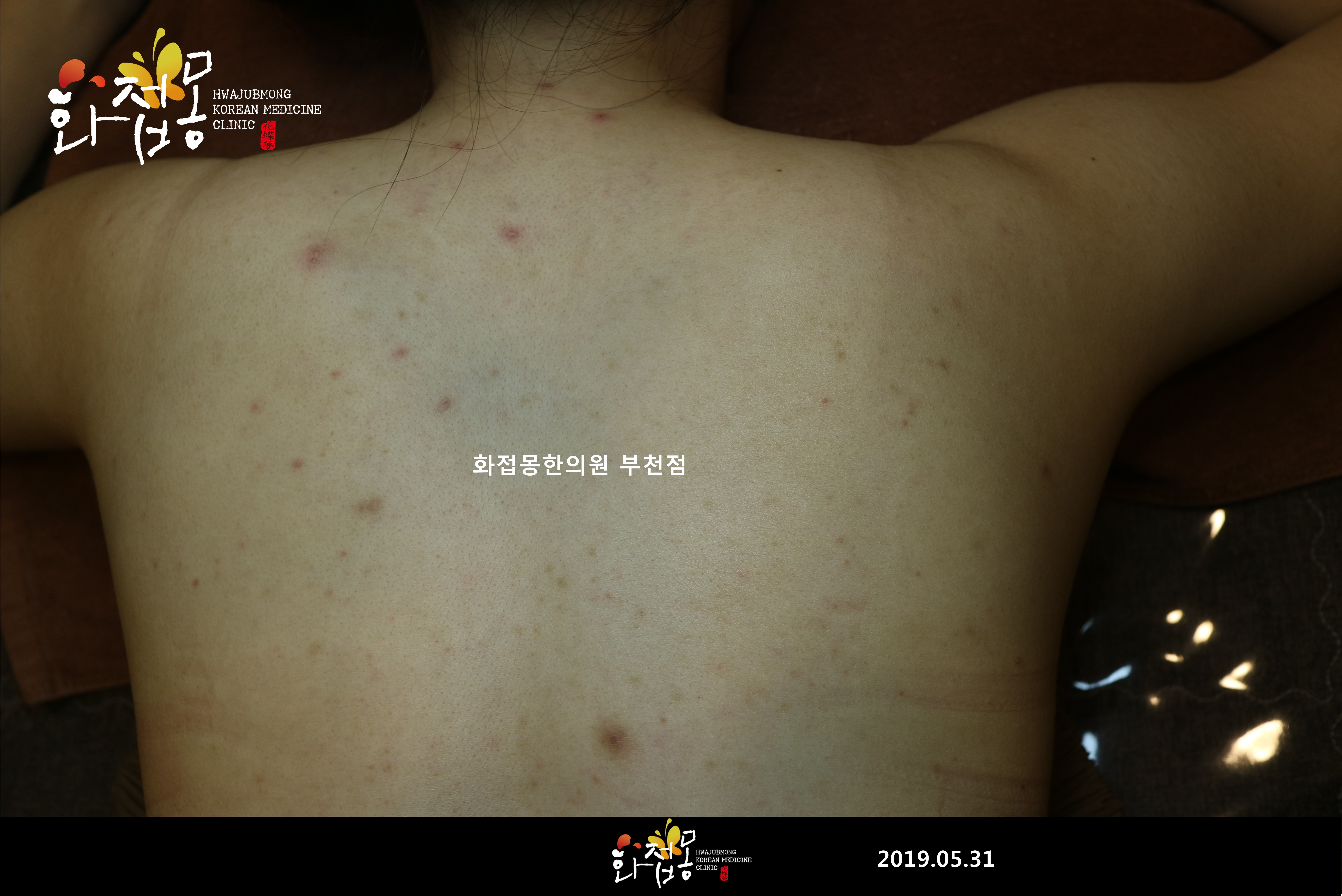 전후사진