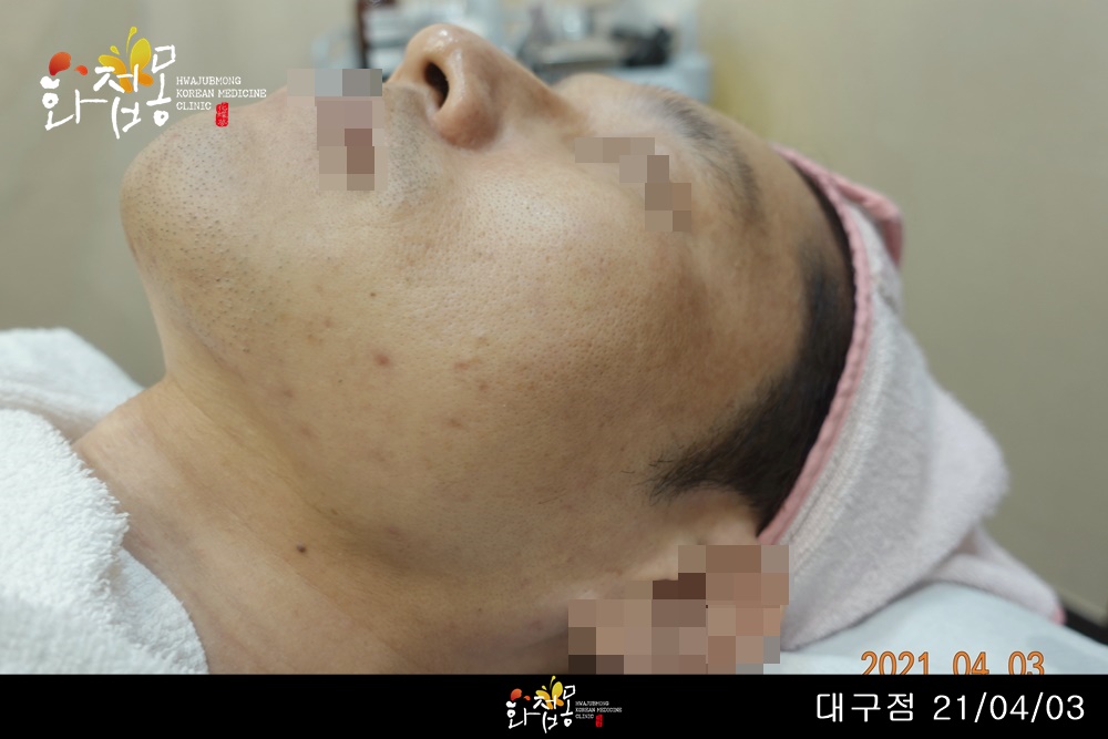 전후사진