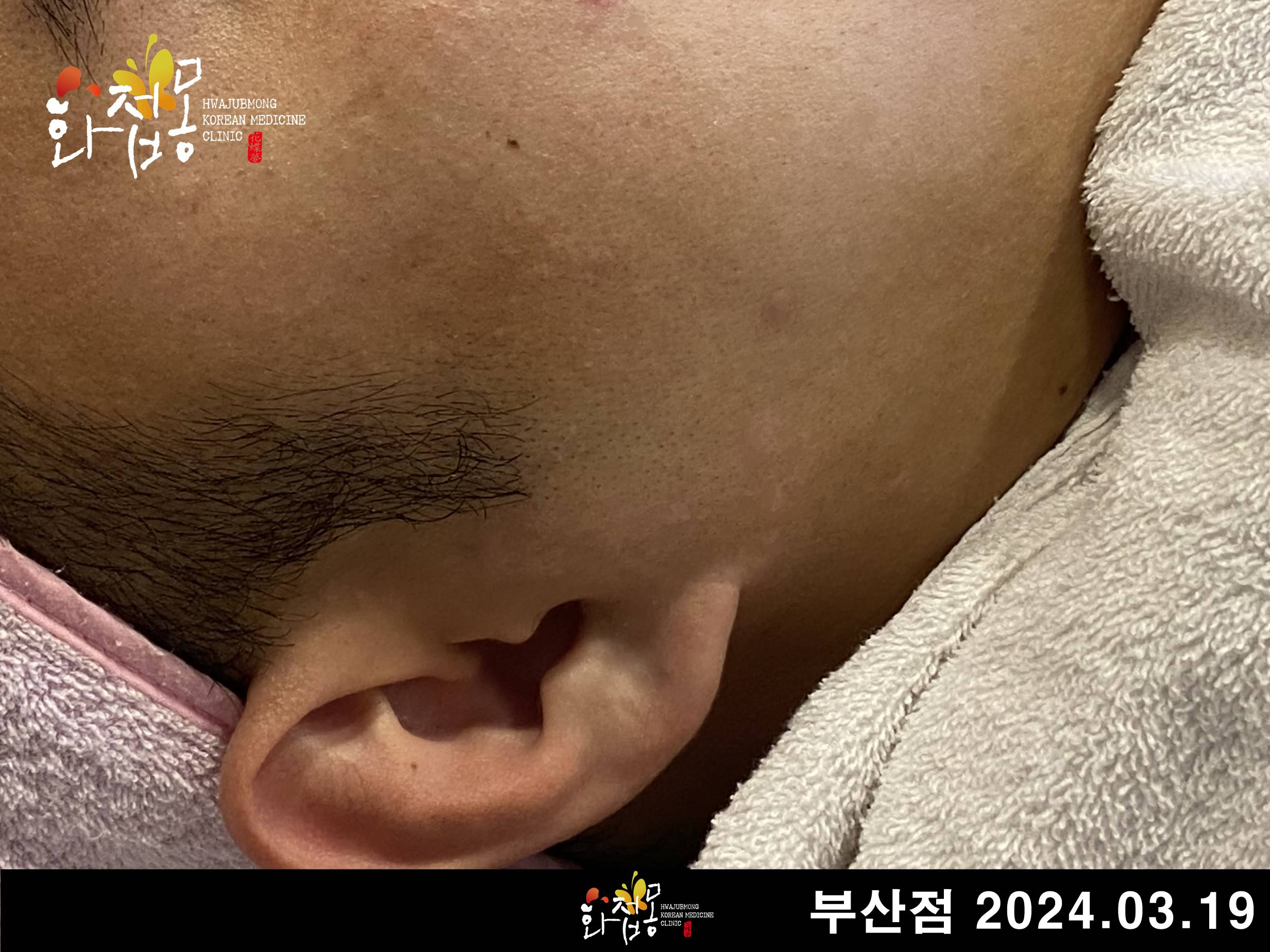 전후사진