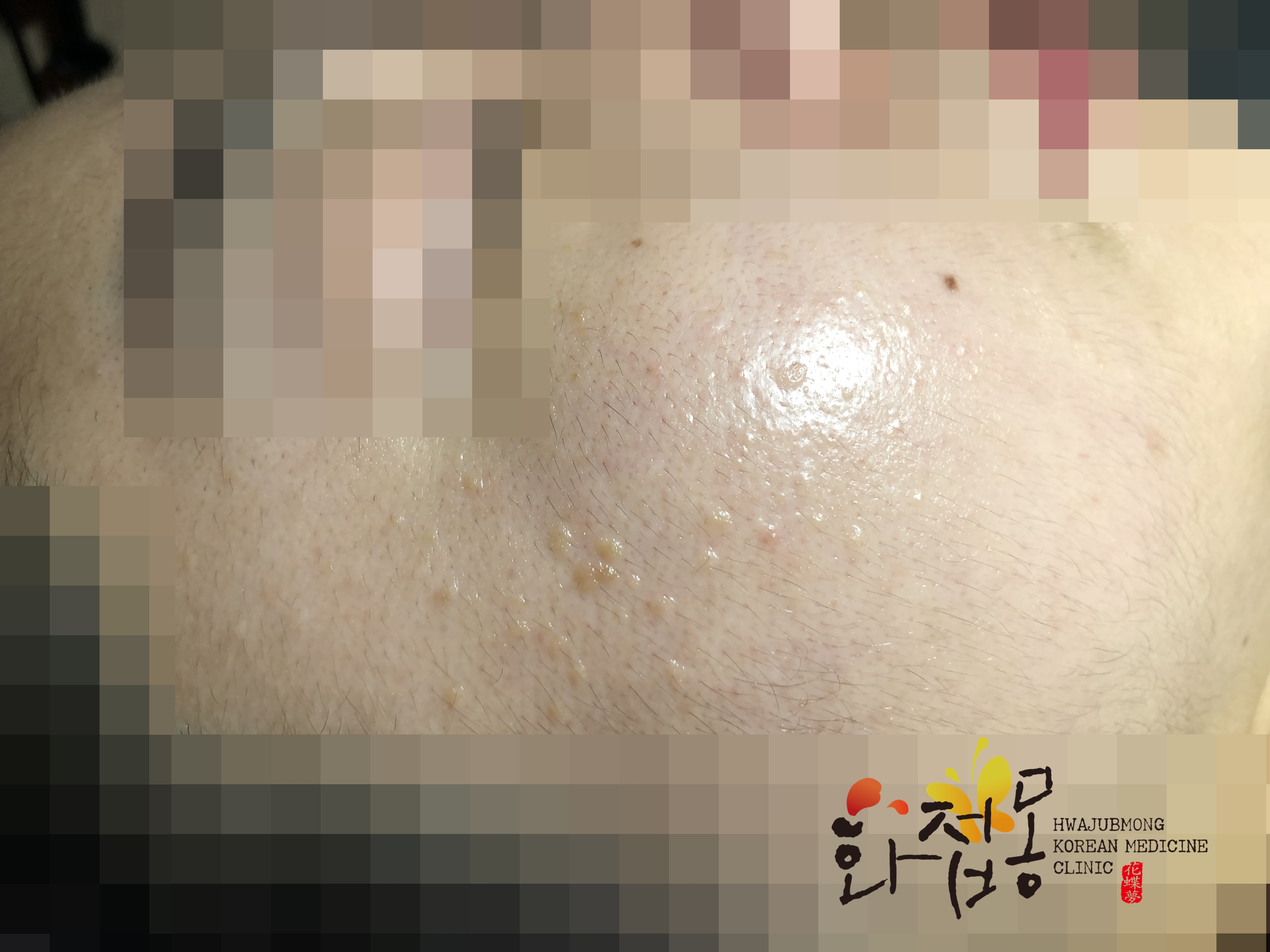 전후사진