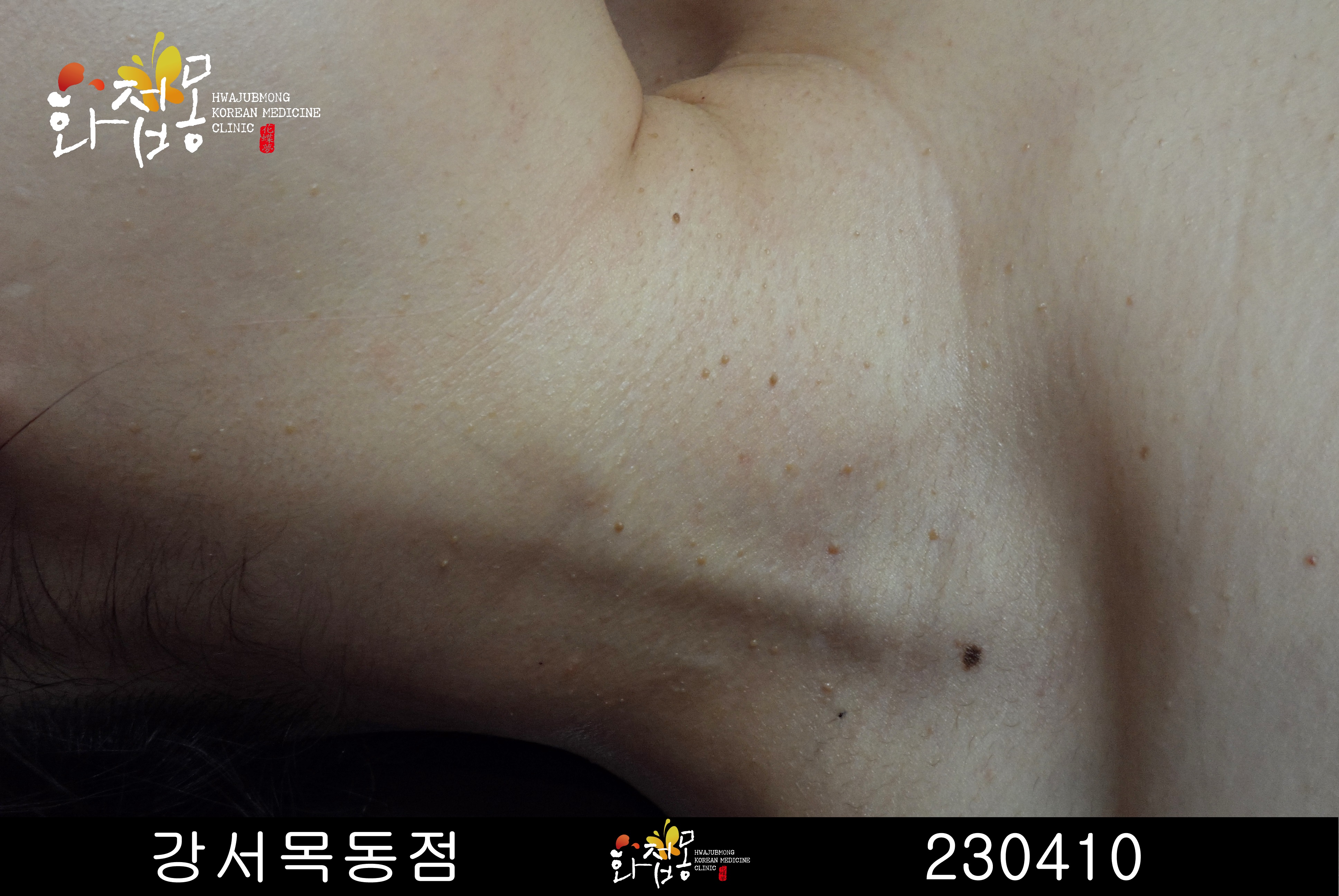 전후사진