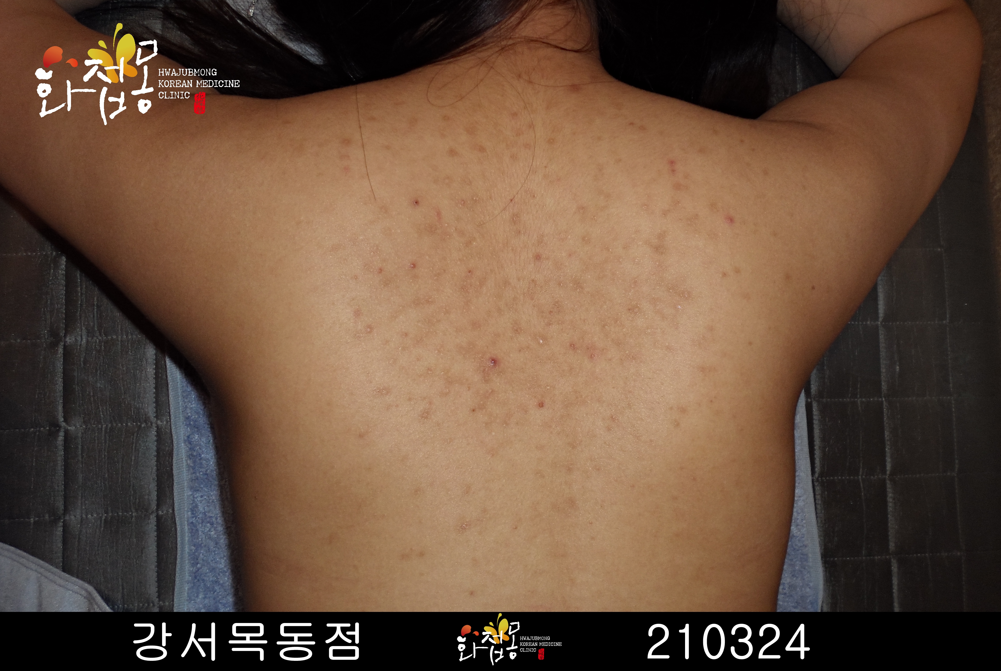 전후사진