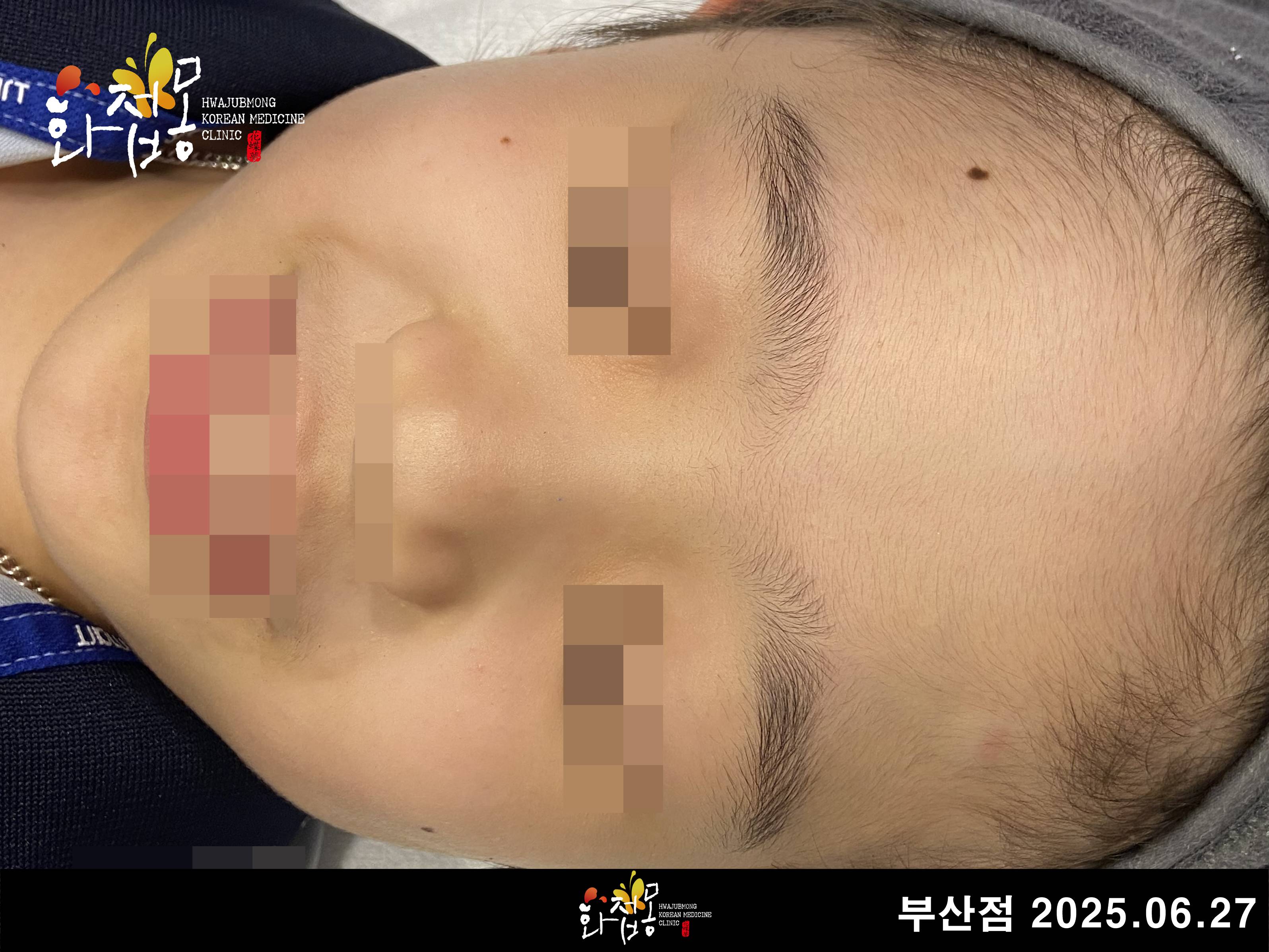전후사진