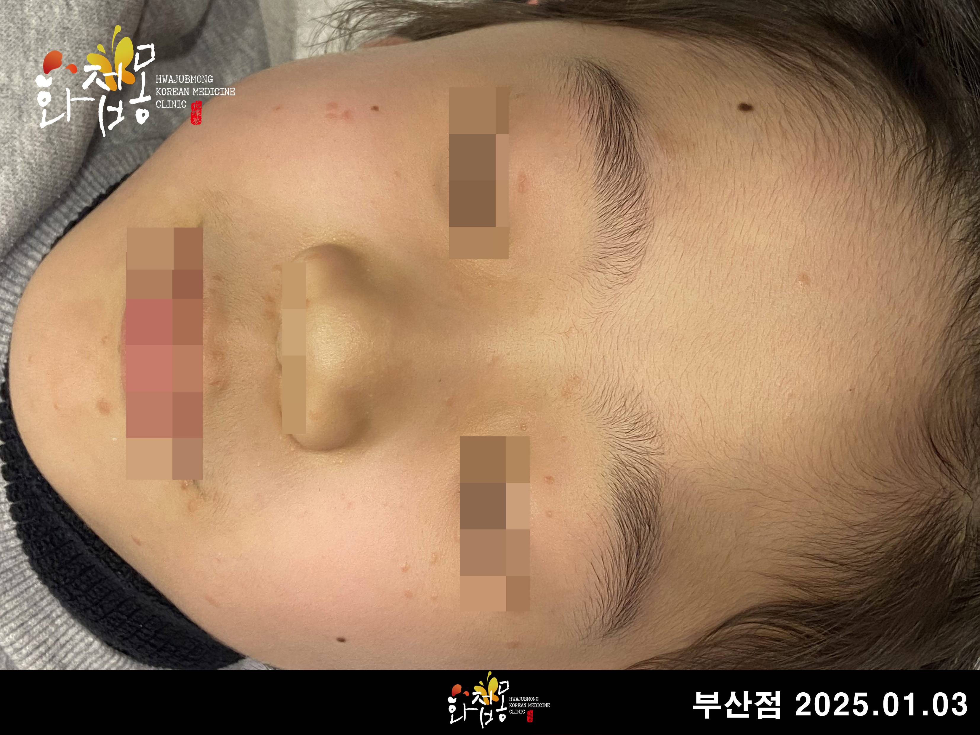 전후사진