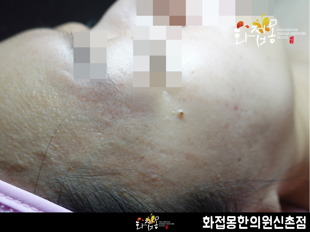 전후사진