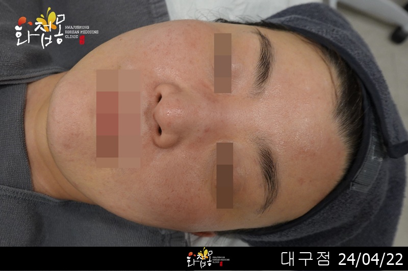 전후사진