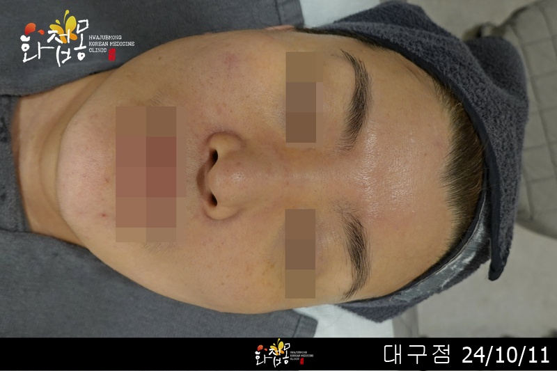 전후사진