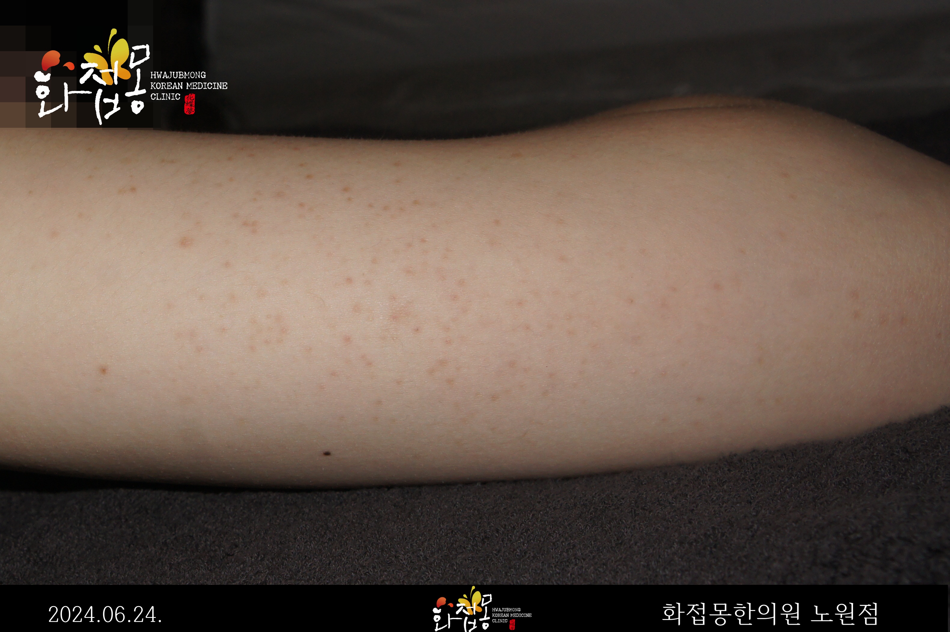 전후사진
