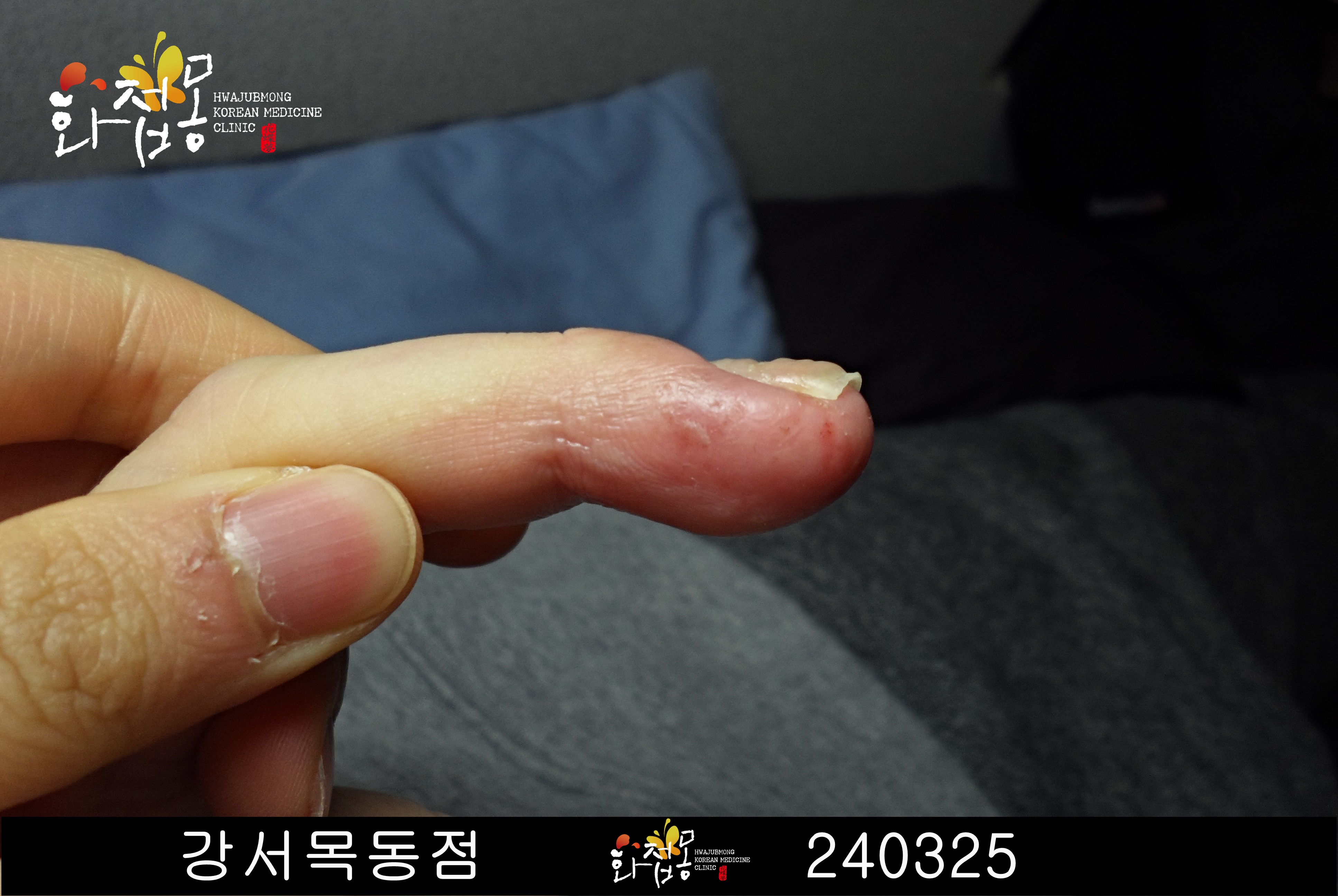 전후사진