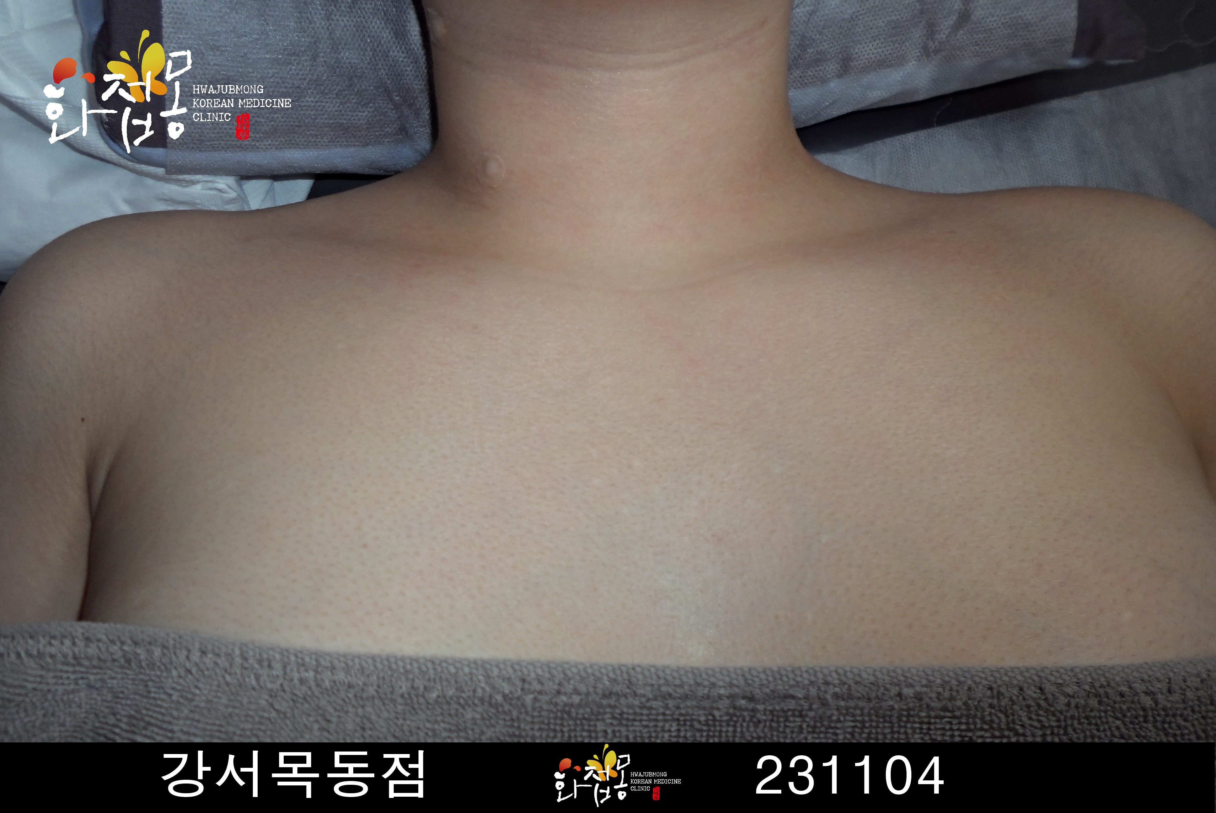 전후사진