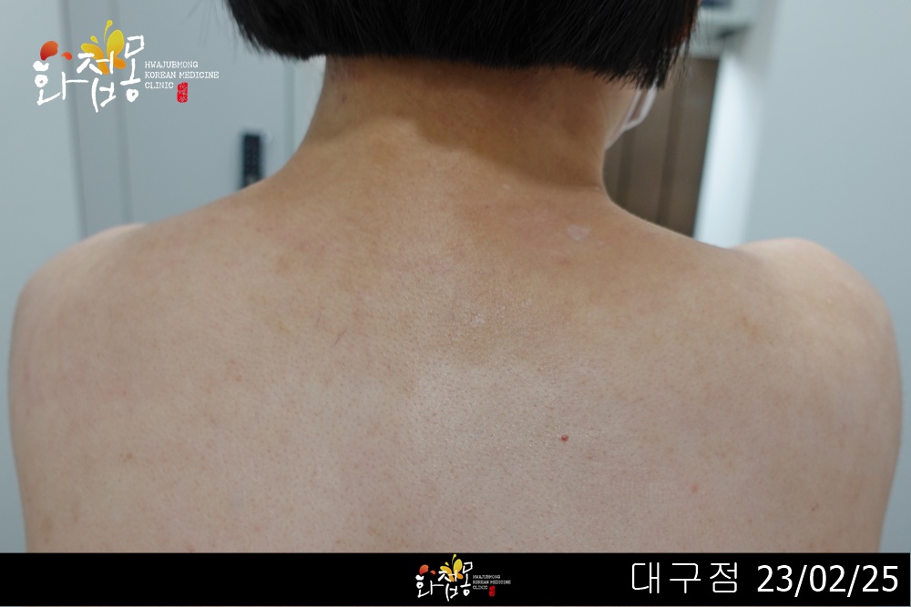 전후사진