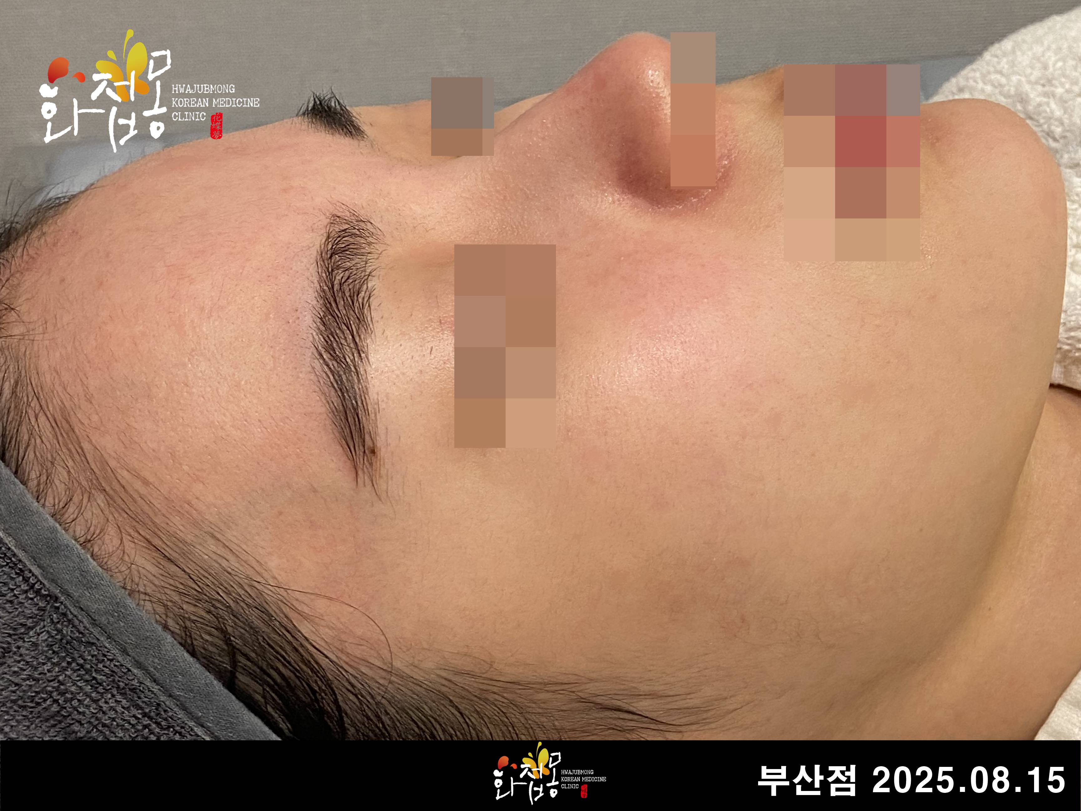 전후사진