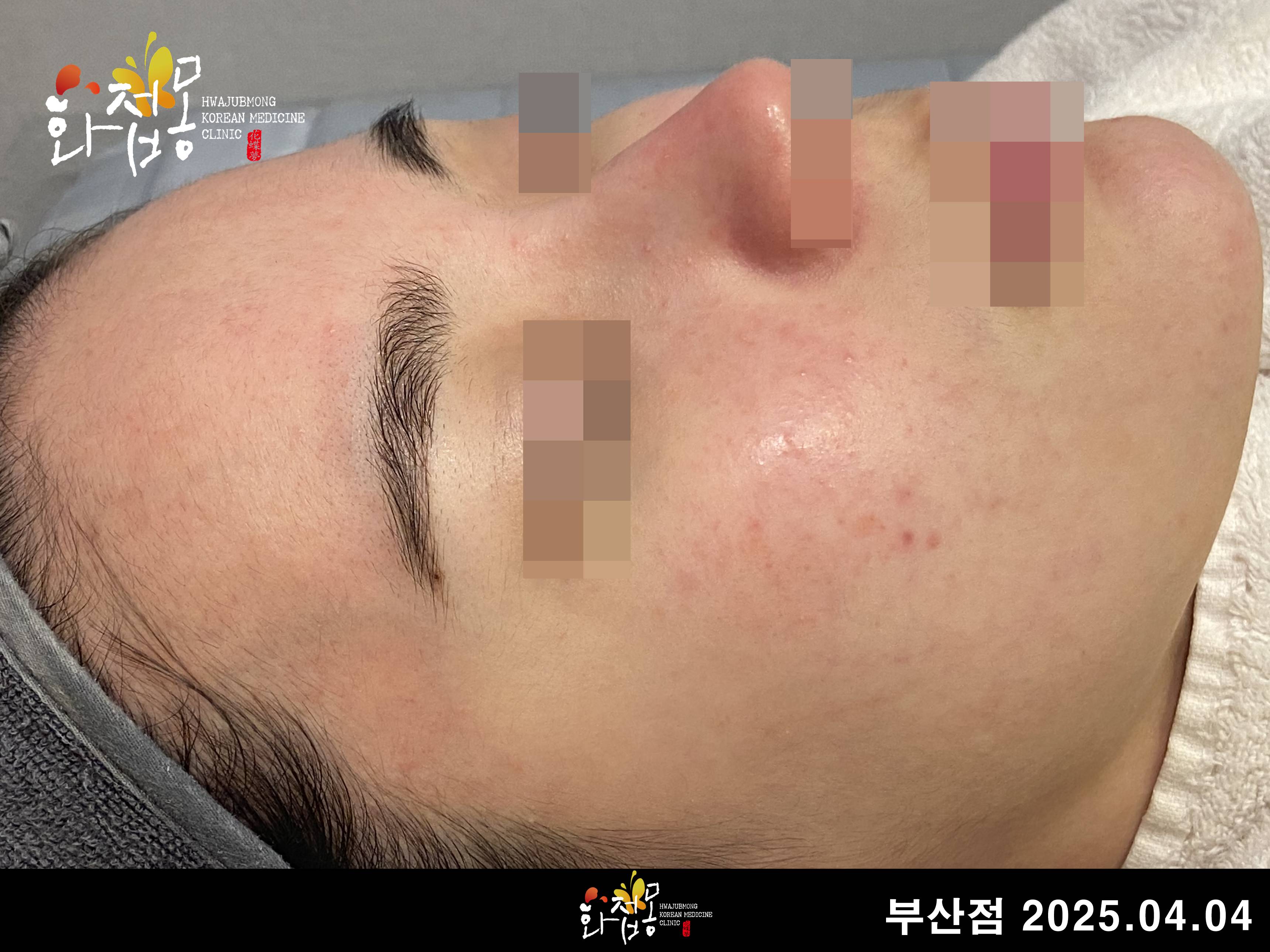 전후사진