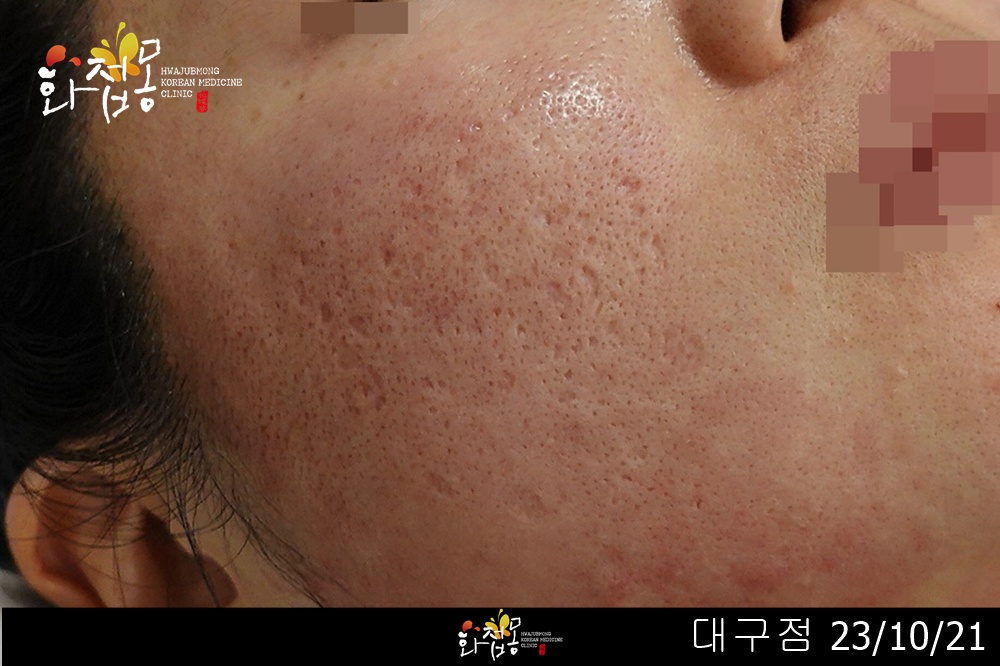전후사진