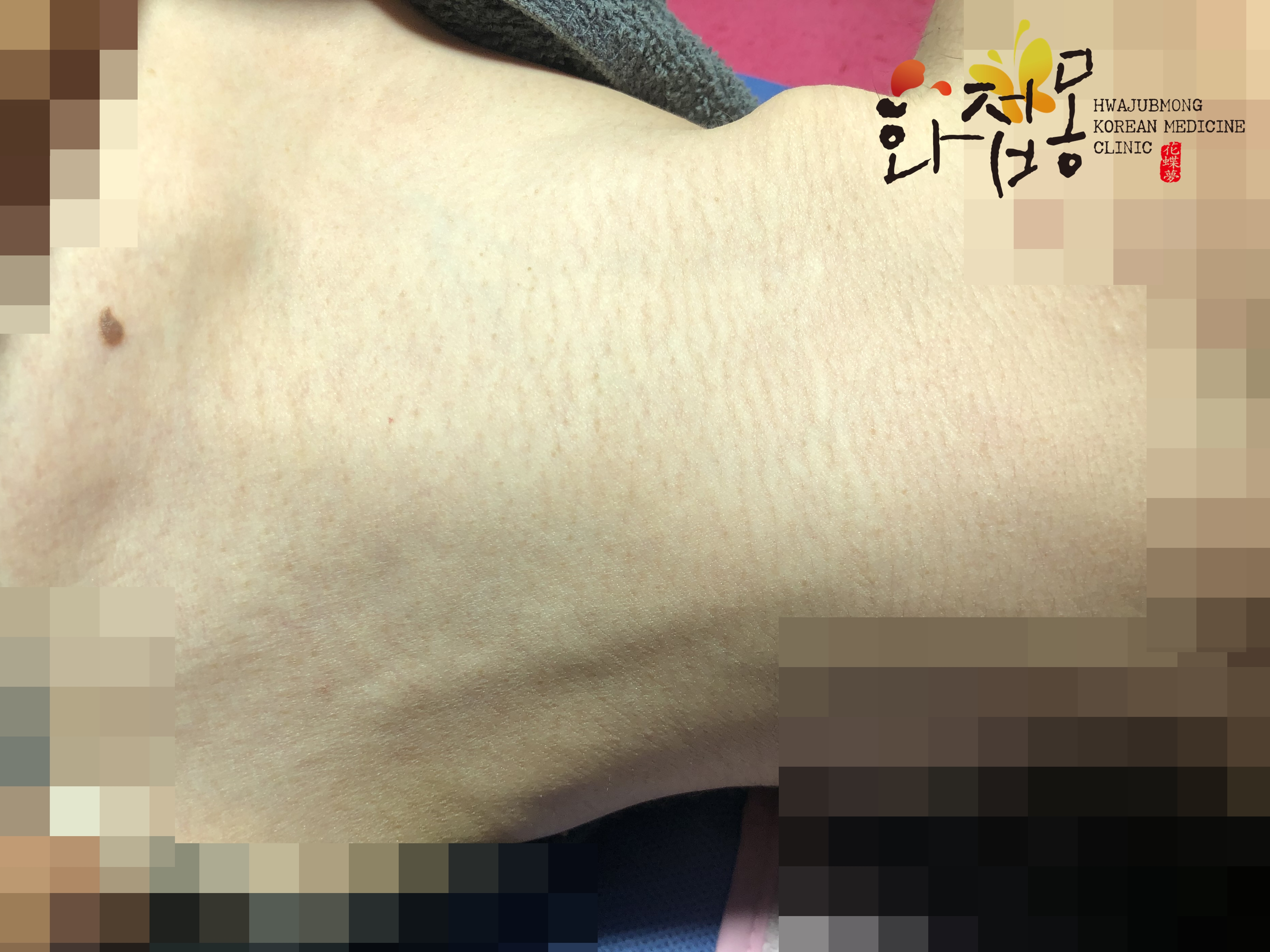 전후사진