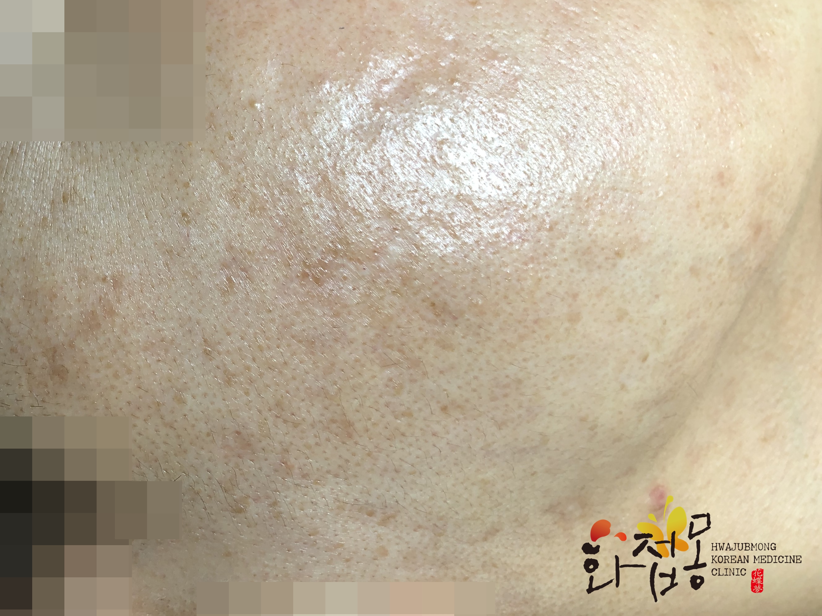 전후사진