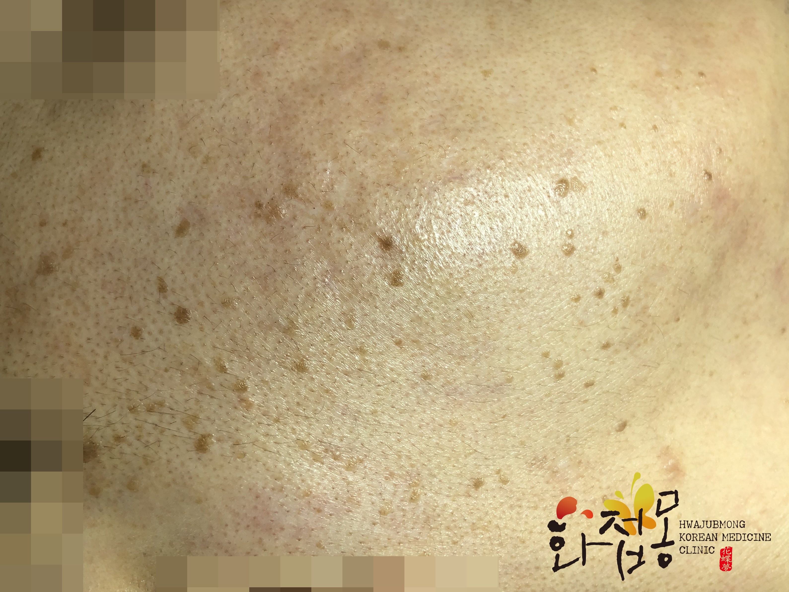 전후사진