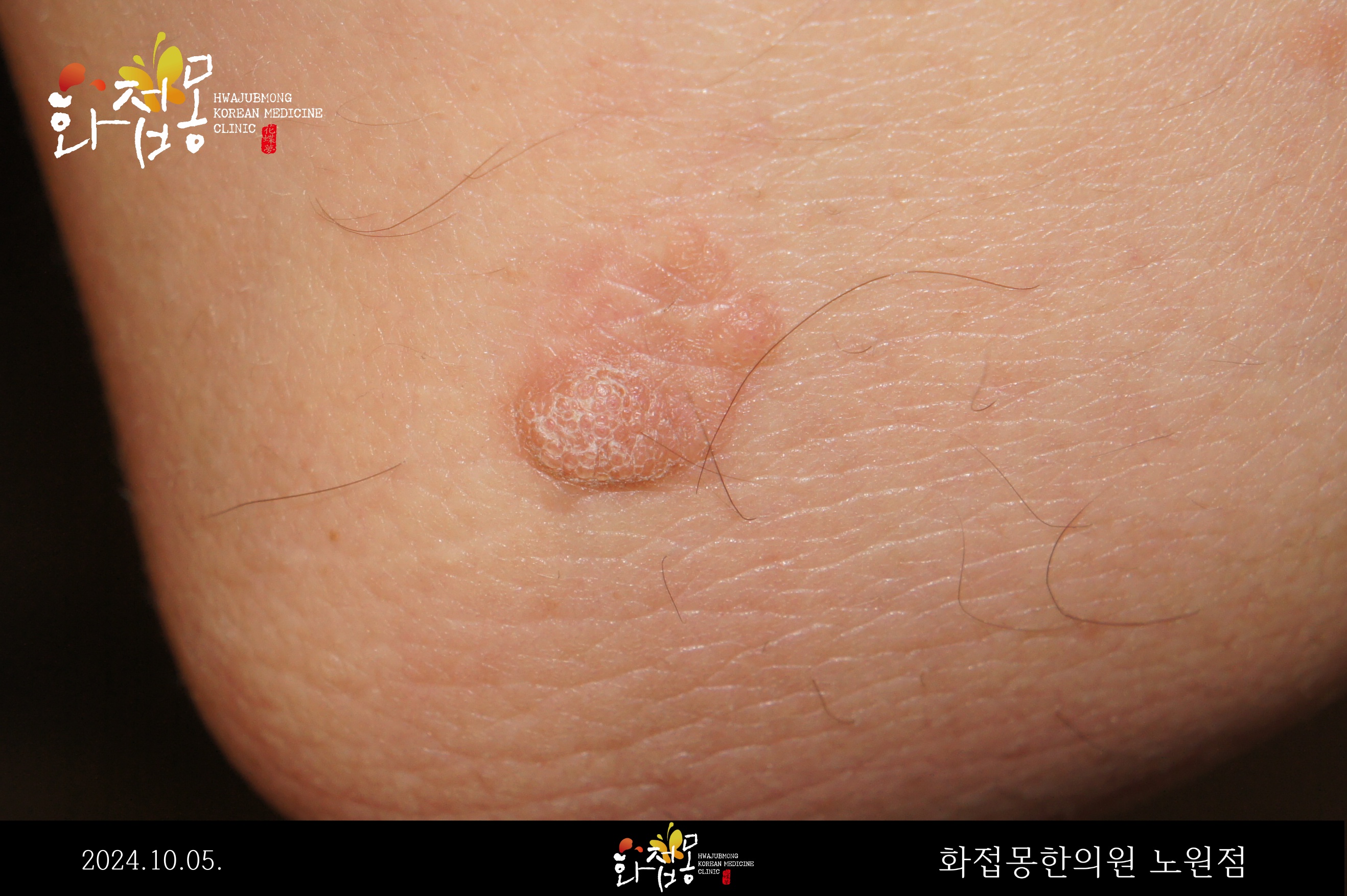 전후사진
