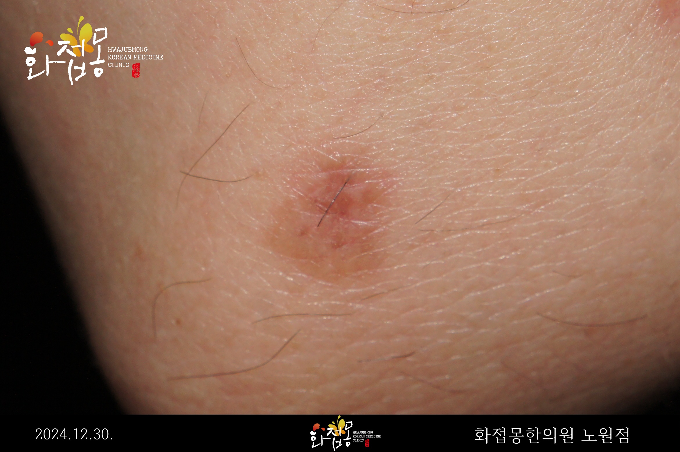 전후사진