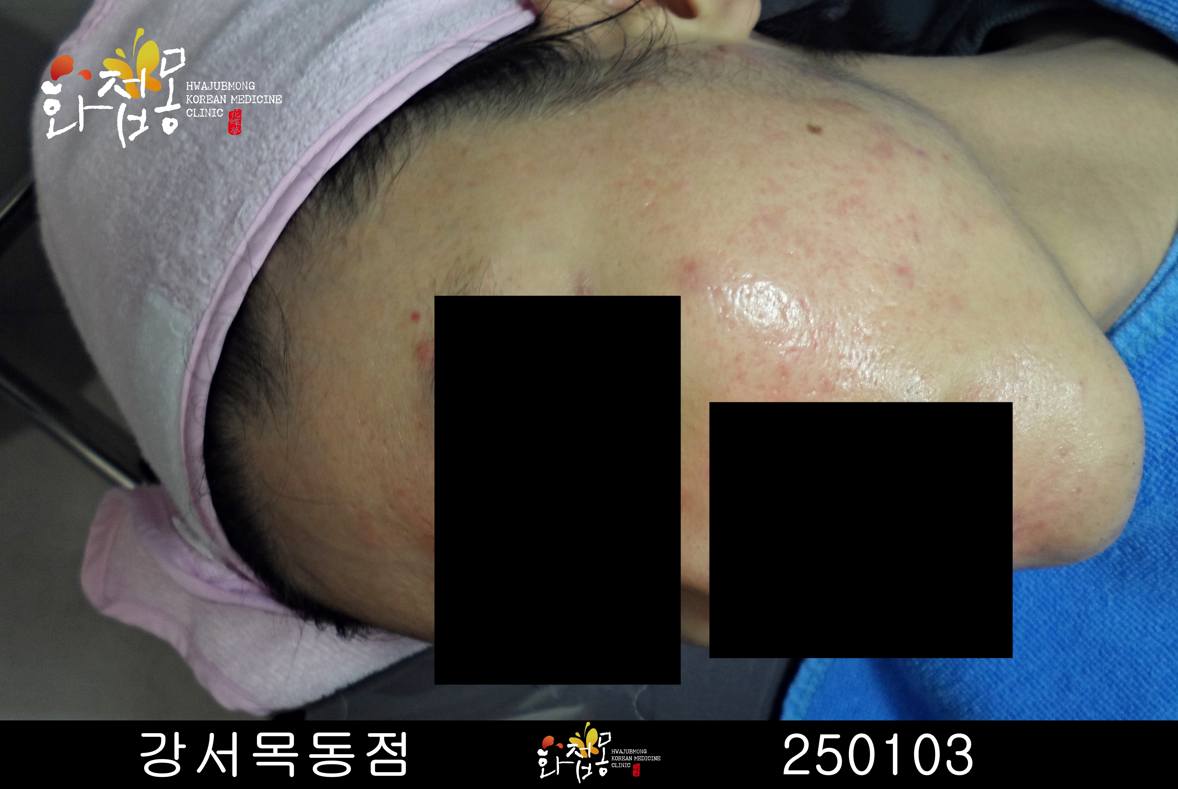 전후사진